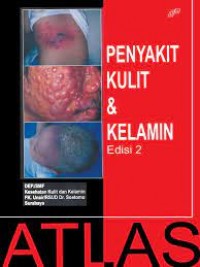 atlas penyakit kulit dan kelamin