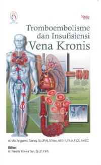 Image of Tromboembolisme dan Insufisiensi Vena Kronis